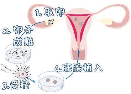 林靜遠